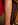 15stitches.jpg (58378 bytes)
